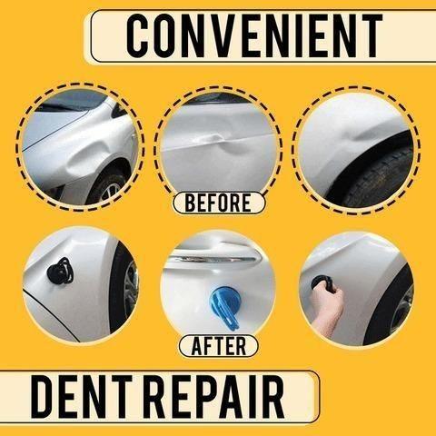Dent Puller- Advance Dent Puller™